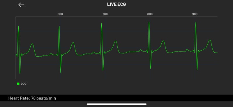 ecg heartbeat graph